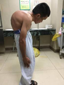 说明: E:\我的新文档\临床病例\陈益兴\患者外观3.jpg